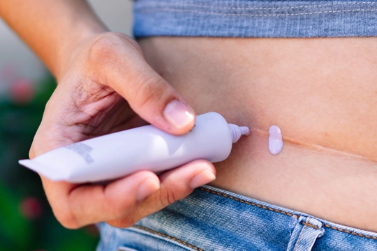 Dikiş İzi Azaltıcı Kremler