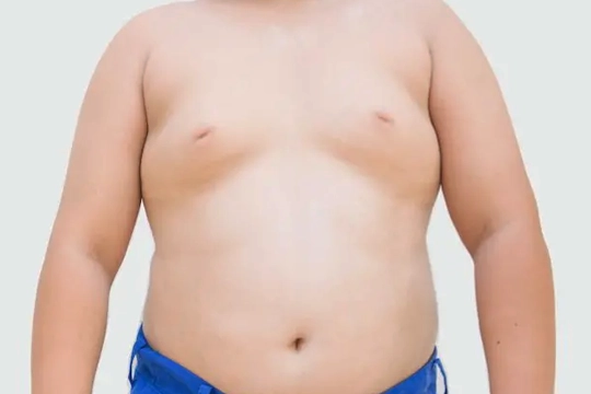 Jinekomasti Hangi Yaşlarda Görülür?