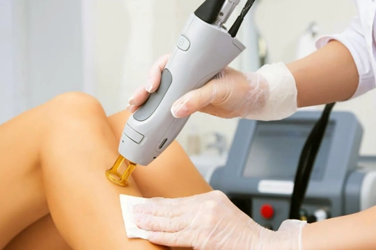 Lazer Epilasyon Çukurambar