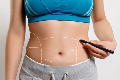 Understanding Tummy Tuck Surgery Risks